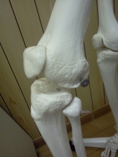膝関節、外側